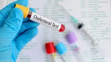 دواء ضد الكوليسترول يقلل كمية "الملوثات الأبدية" في الدم